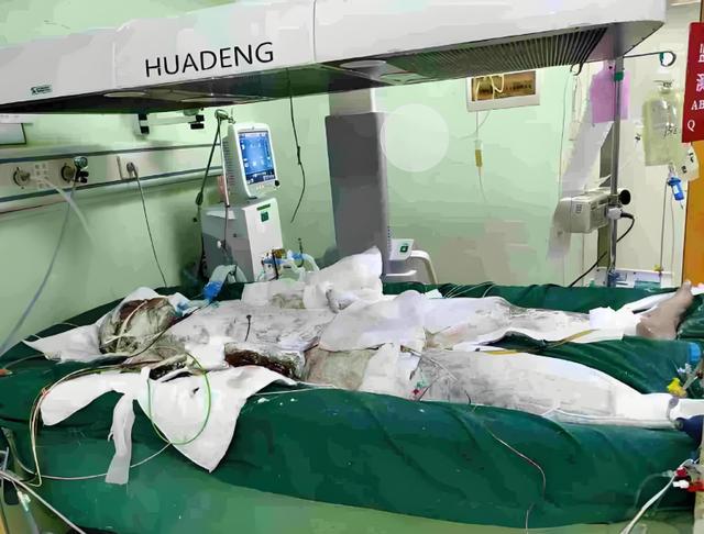 B·sport（中国体育）：7手电动车爆燃18岁少年殒命前6位车主成被告均需担责(图2)